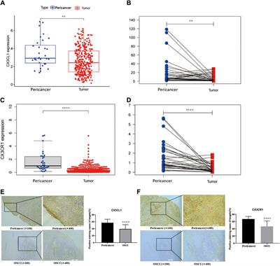 Induction of CX3CL1 expression by LPS and its impact on invasion and migration in oral squamous cell carcinoma